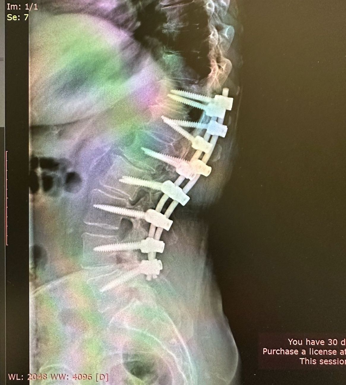 Valerio Cipolloni-29