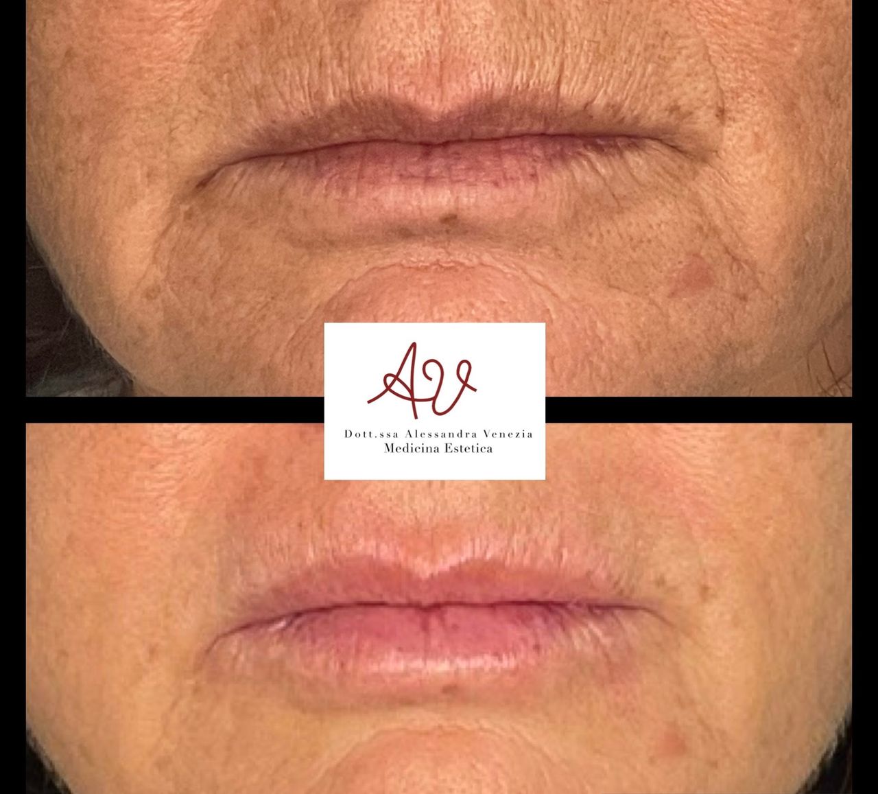 Alessandra Venezia-23