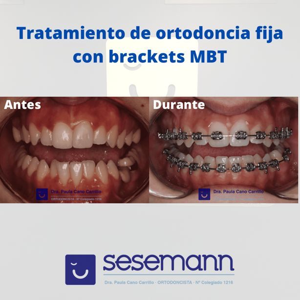 Paula Cano Carrillo-106