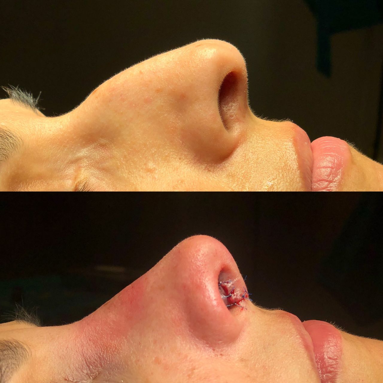 Alberto Candau Álvarez-24