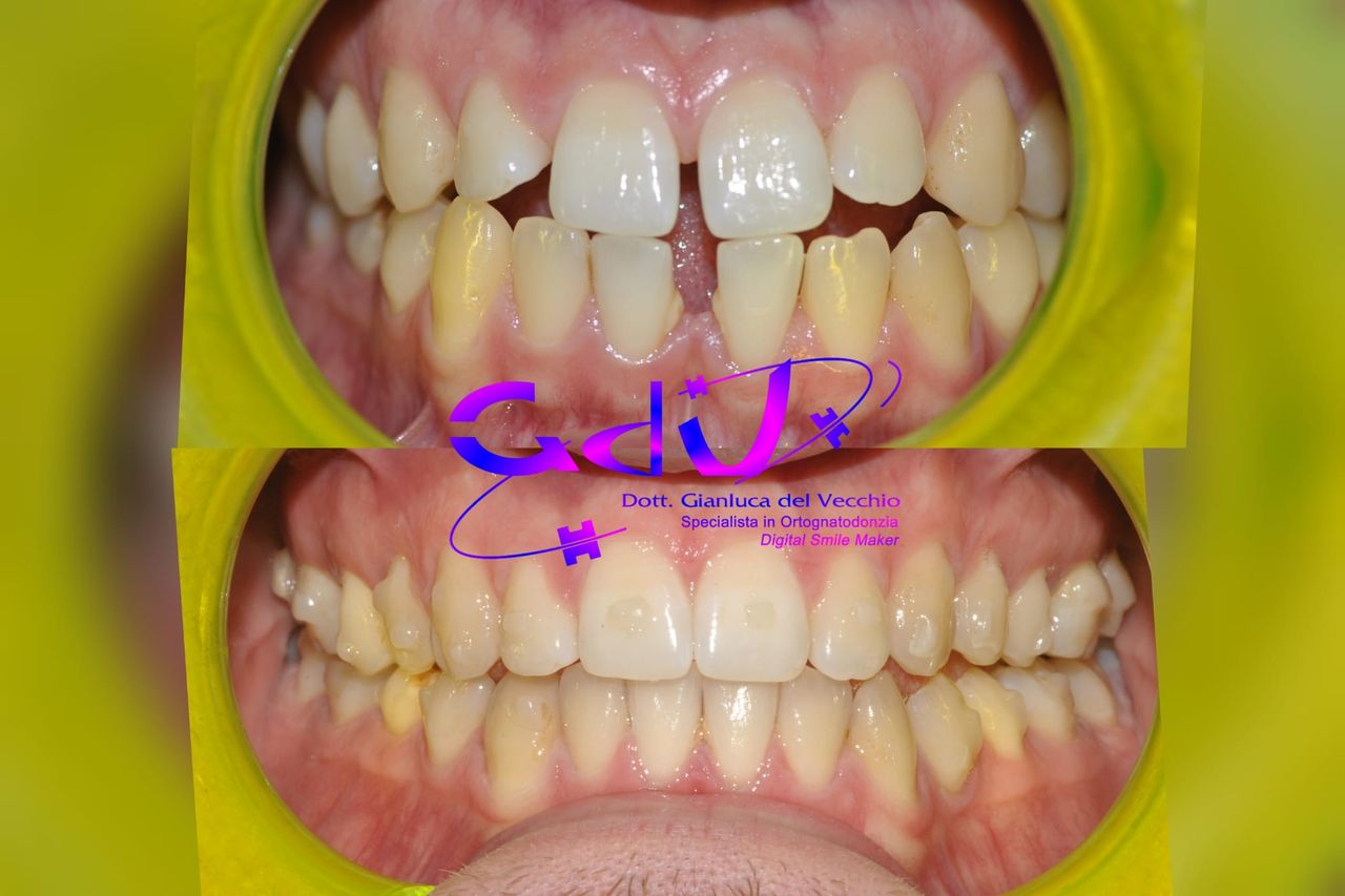 Gianluca Del Vecchio-181