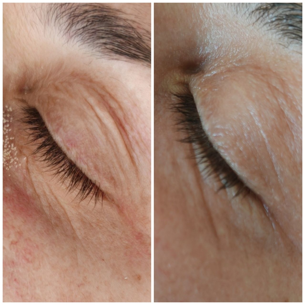 Michele Picciallo-21