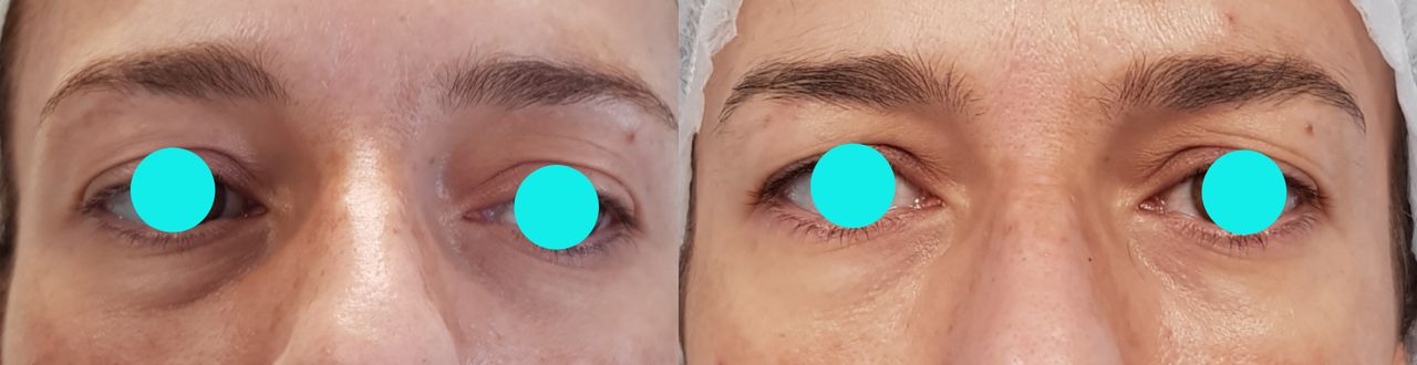 Rosalba Herrero Zerpa-217