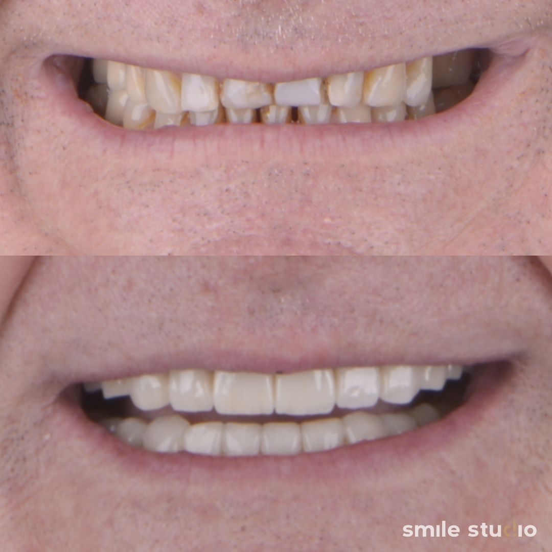 Michał Jankowski-13