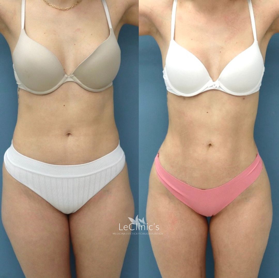 Irasema Regla Bezares Ramos-2