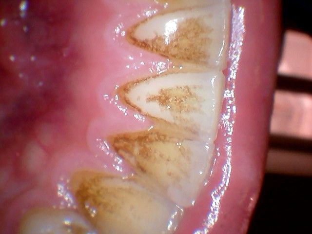 Michaela Houšková, Dis.et Dis.-3