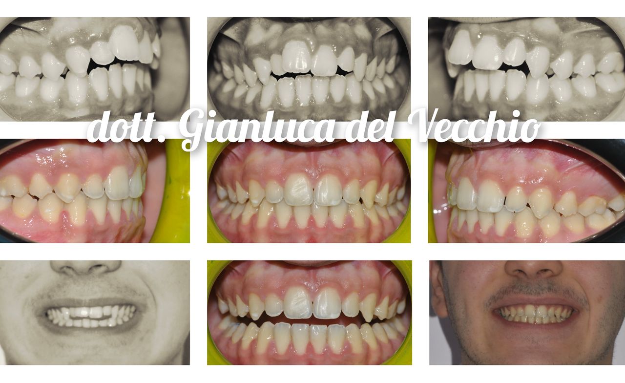 Gianluca Del Vecchio-71