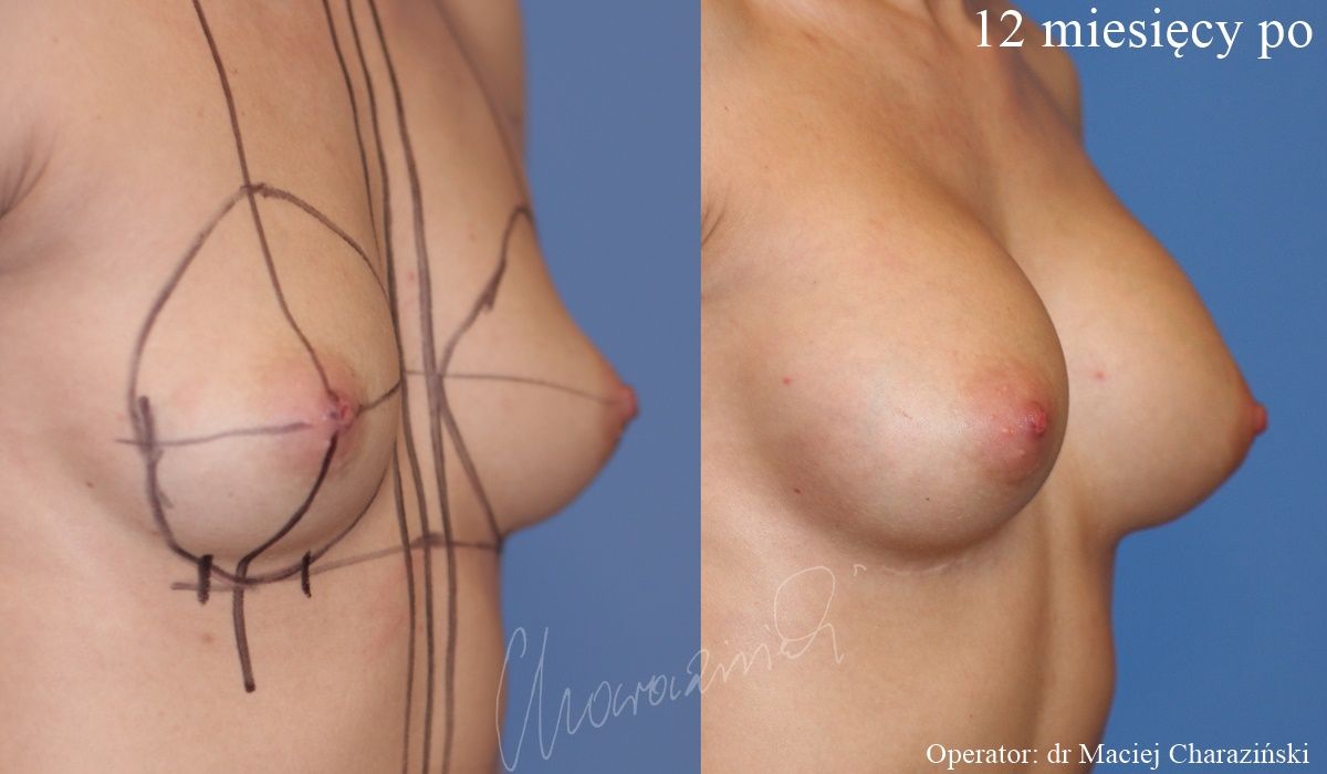 Maciej Charaziński-104