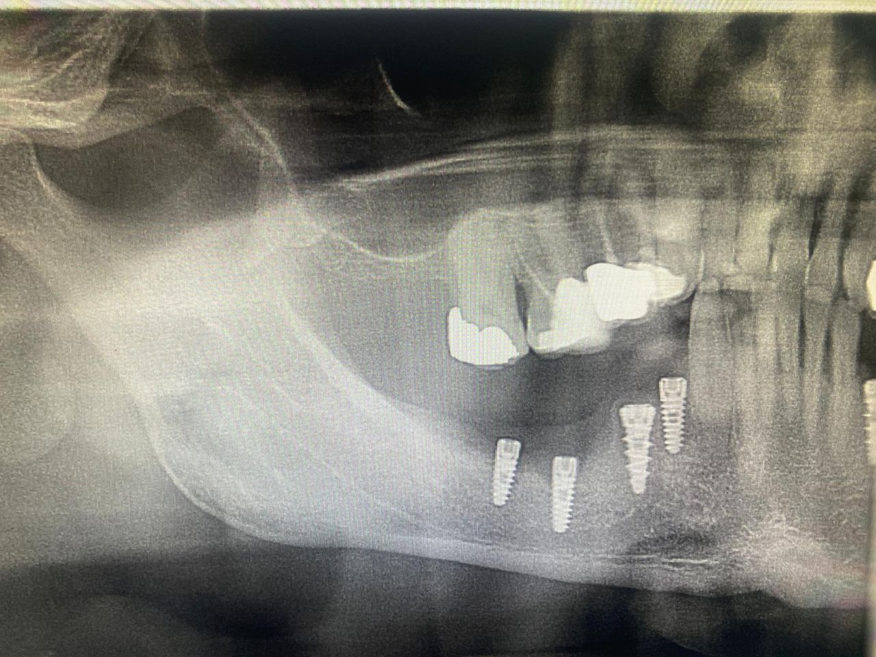 Luigi Giuseppe Romano-17