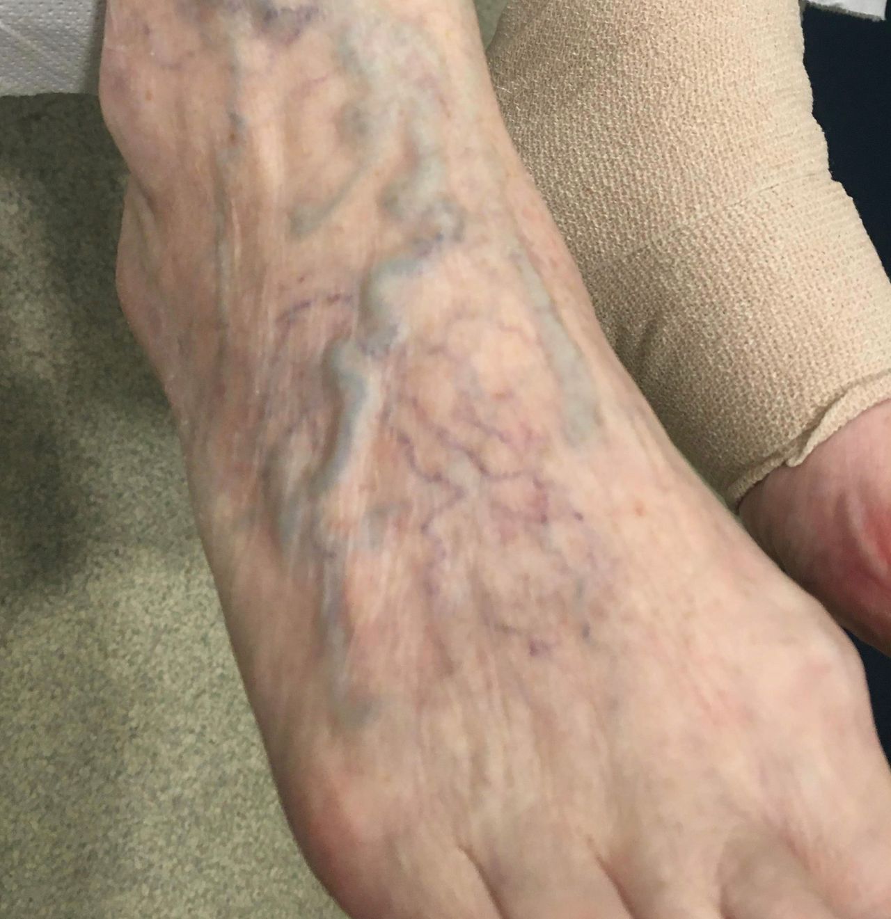 Arnaldo Strazzaboschi-10