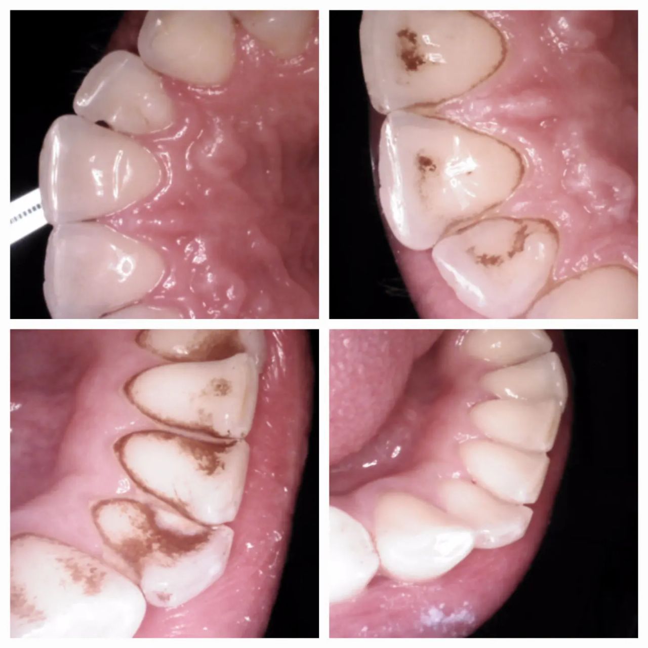 Katarzyna  Kmieć -10