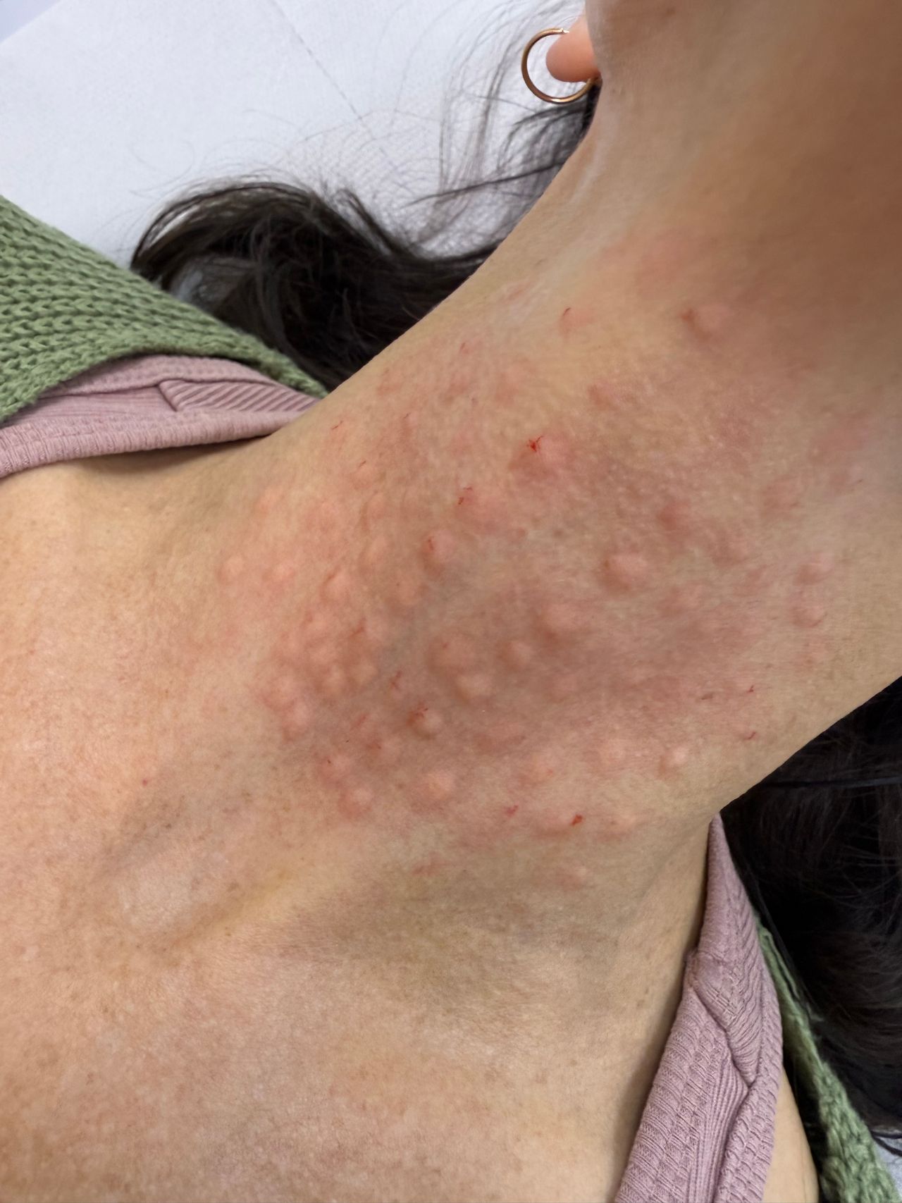 Aleksandra  Plata-Babula-19