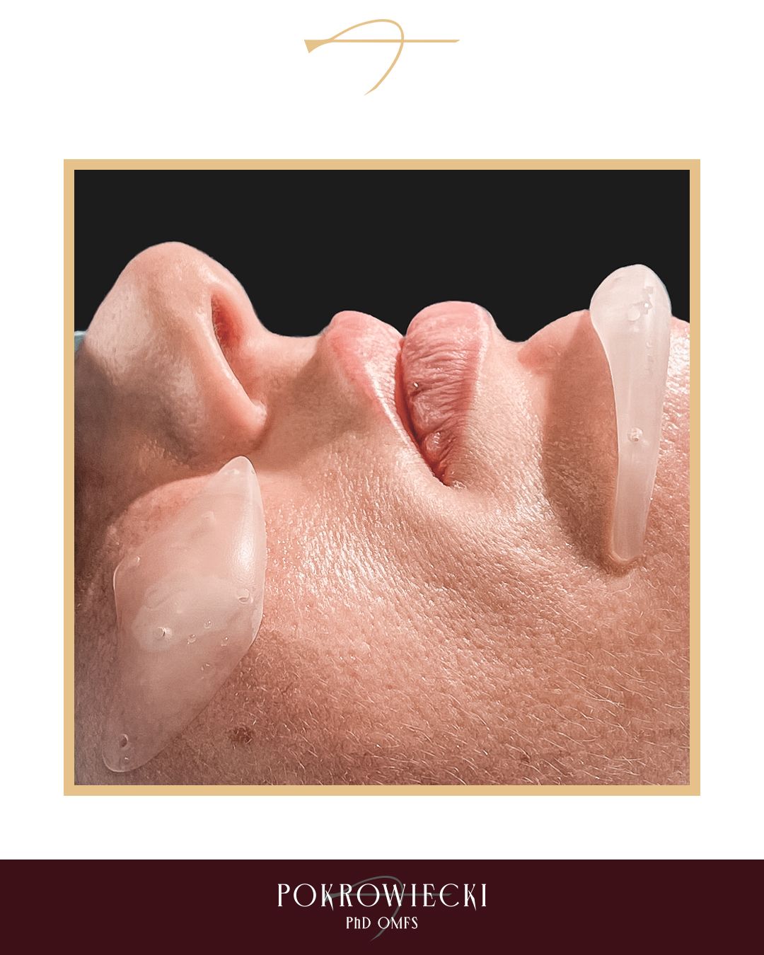 Rafał Pokrowiecki-4