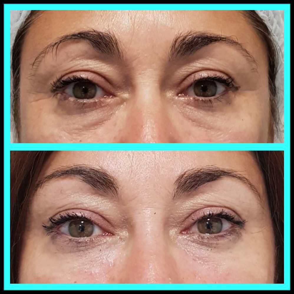 Rosalba Herrero Zerpa-356