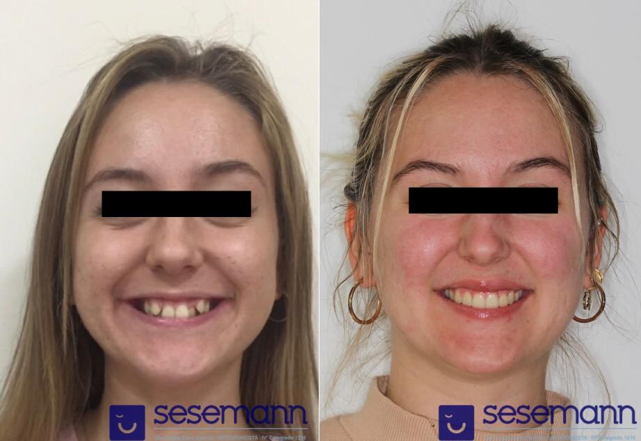 Paula Cano Carrillo-20