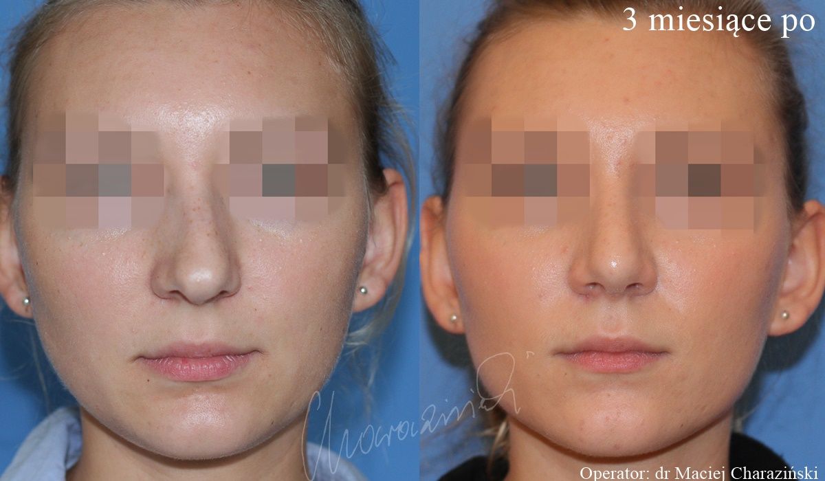 Maciej Charaziński-51