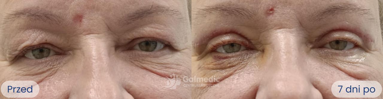 Aneta Michalik-Jakubek-6