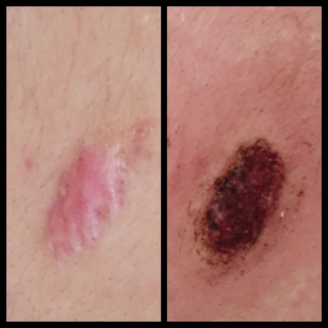 Andrea Menichelli-15