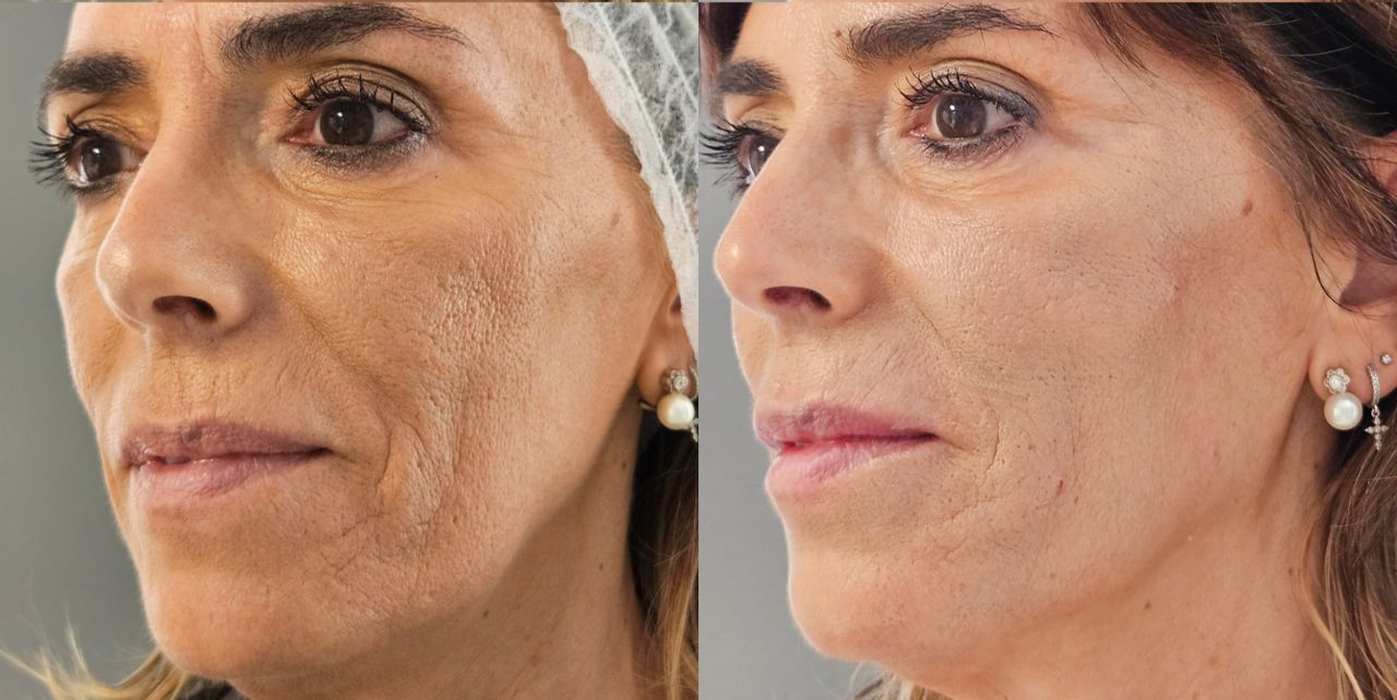 Rosalba Herrero Zerpa-33