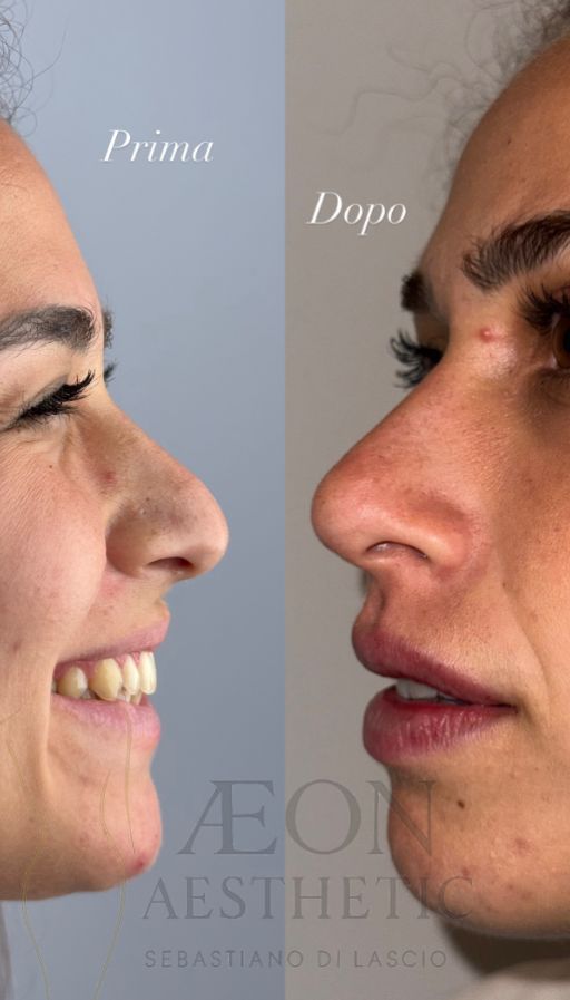 Sebastiano Di Lascio-2