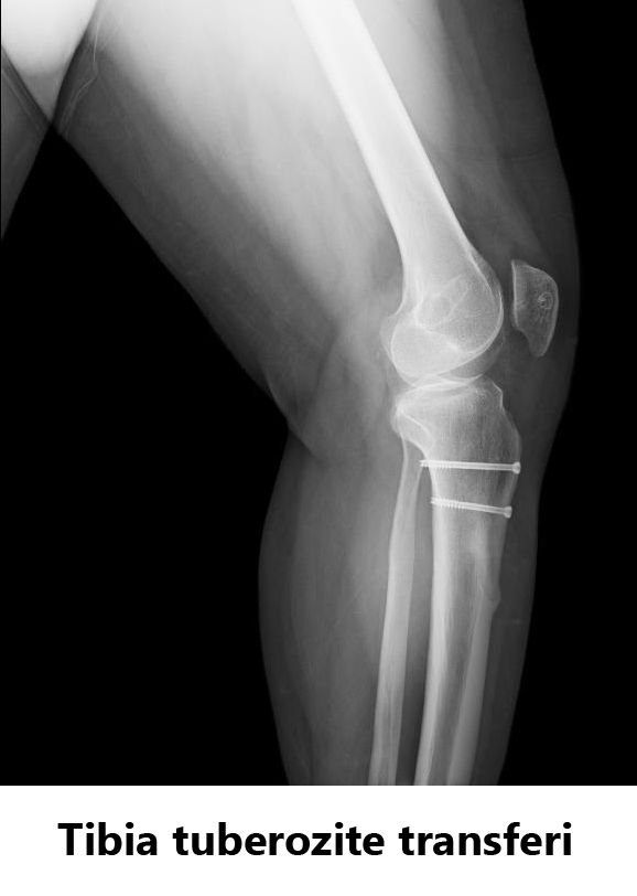 Javid M. Azarabadı-16