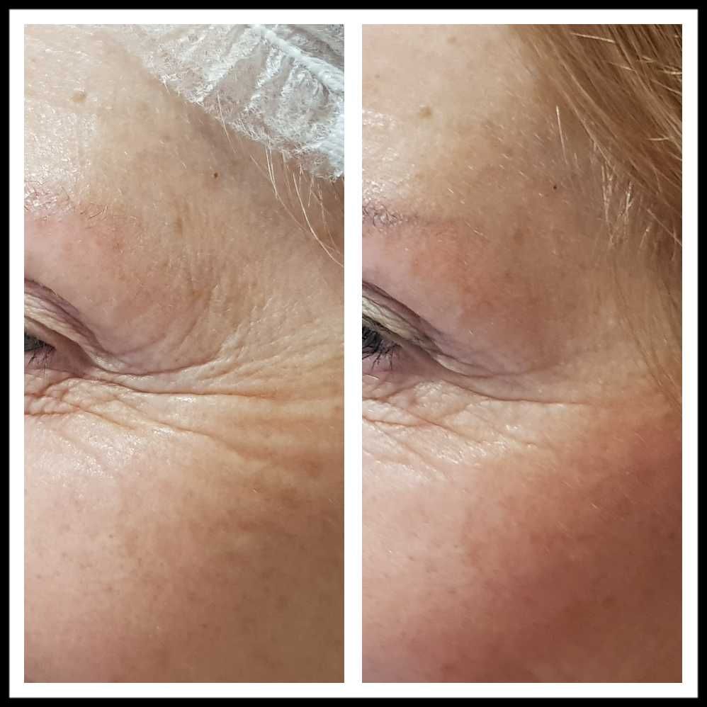 Rosalba Herrero Zerpa-343