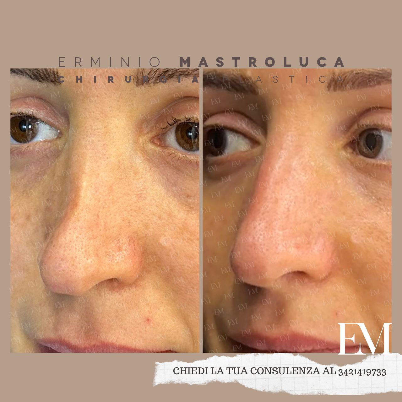 Erminio Mastroluca-12