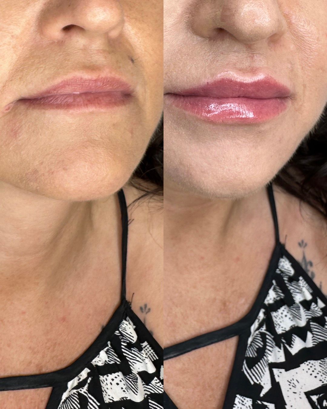 Michalina Zagańczyk-Bączek-25