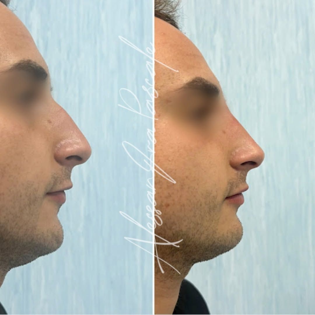 Alessandra Pascale-7