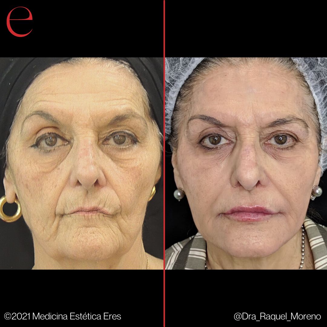 Raquel Moreno Pentinel-88