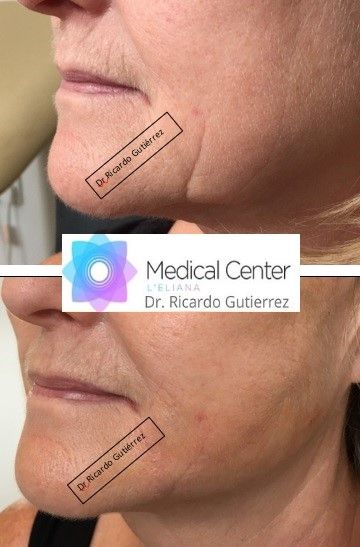 Ricardo Gutierrez Fayos-3