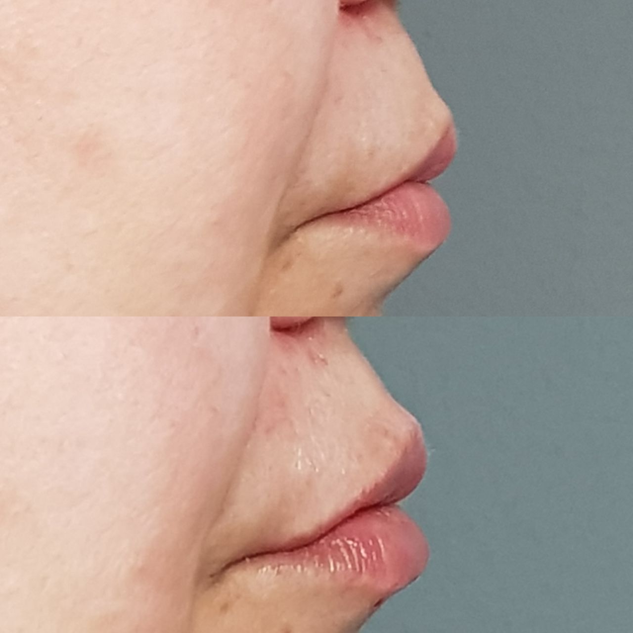 Rosalba Herrero Zerpa-225