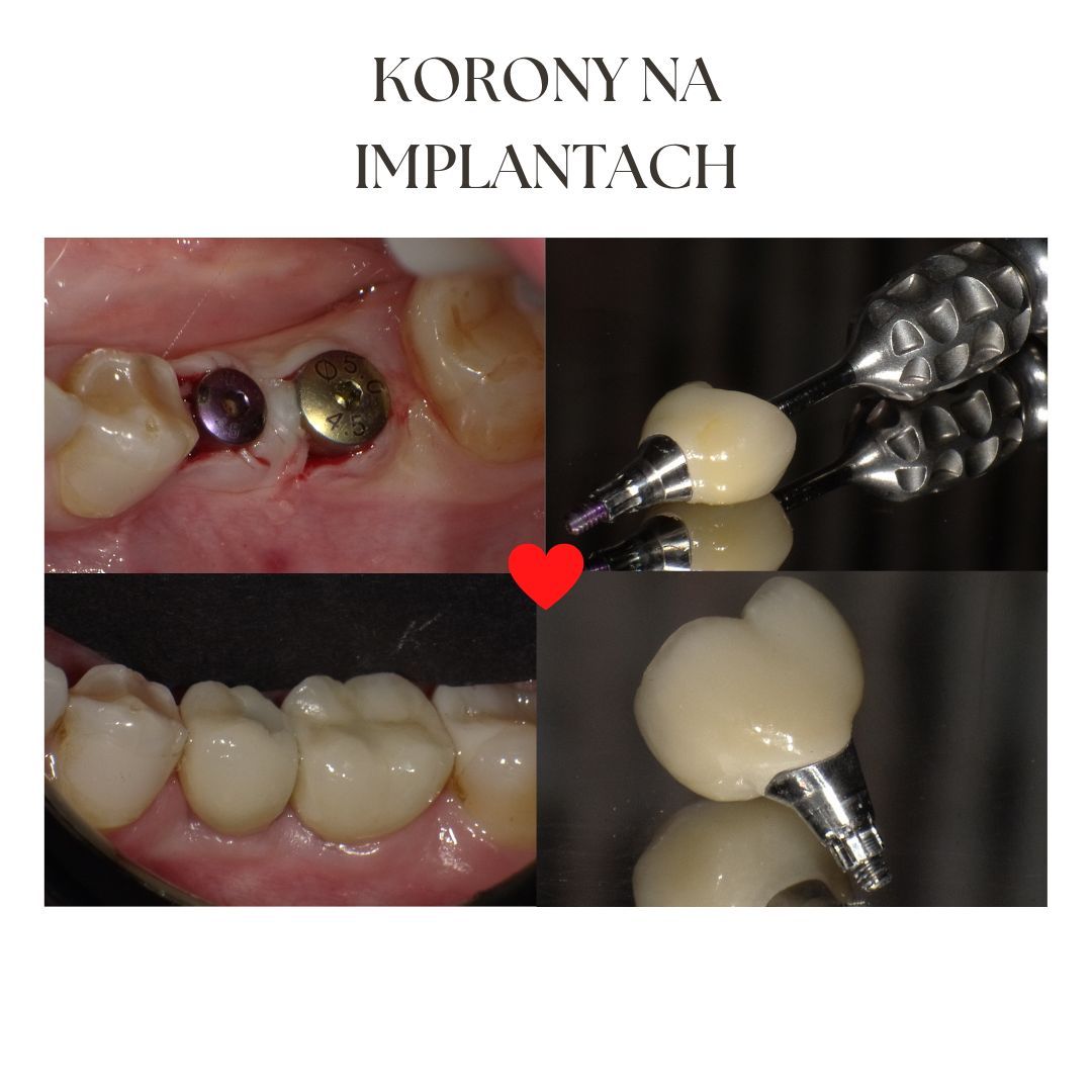 Magdalena Przybysz-17