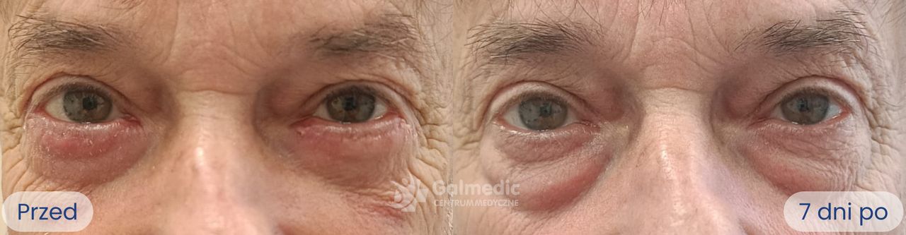 Aneta Michalik-Jakubek-8