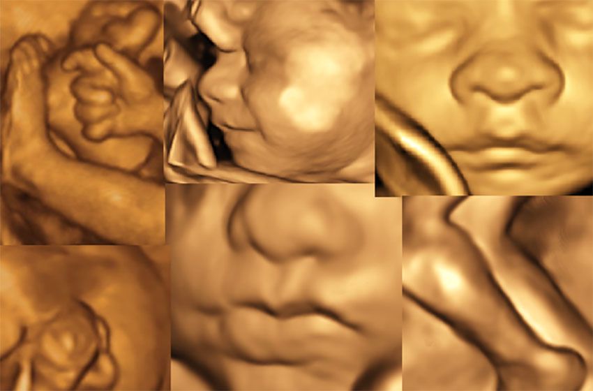 Antonella Napolitano-25