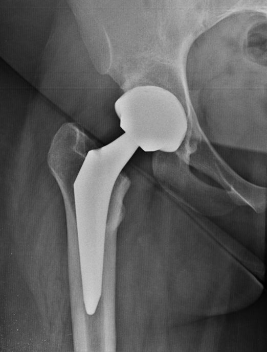 Antonello Della Rocca-12