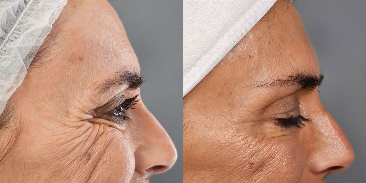 Rosalba Herrero Zerpa-30