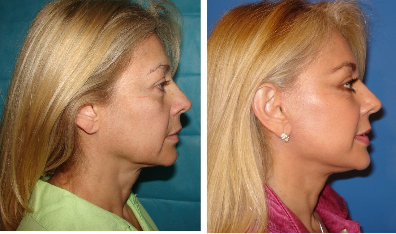 Jaime Eduardo Chacón Hernández-10