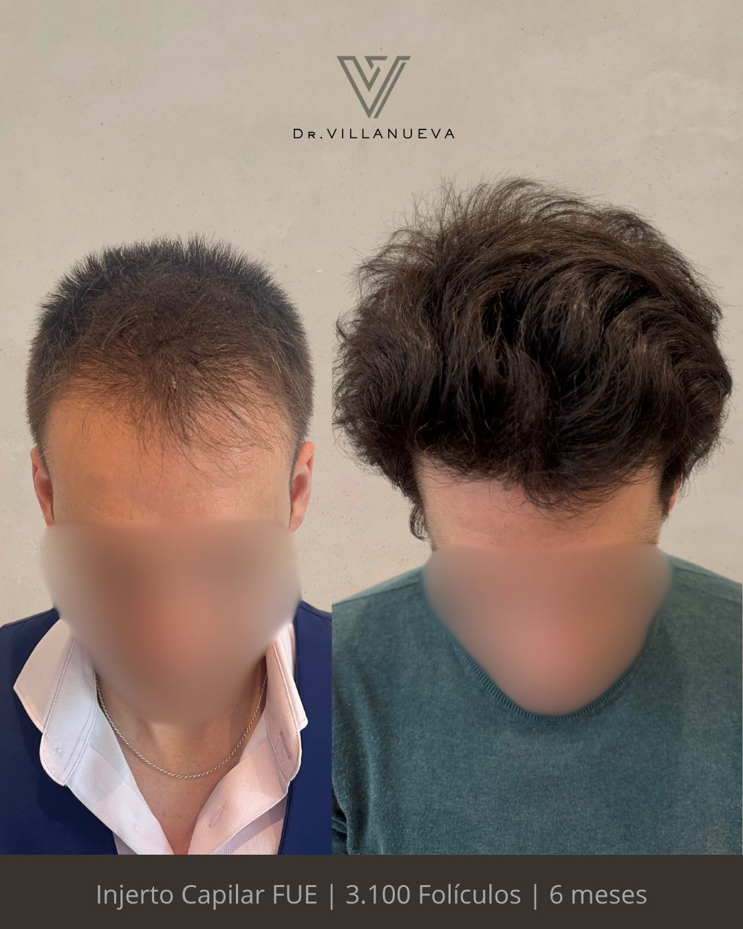 Alfredo Villanueva-7