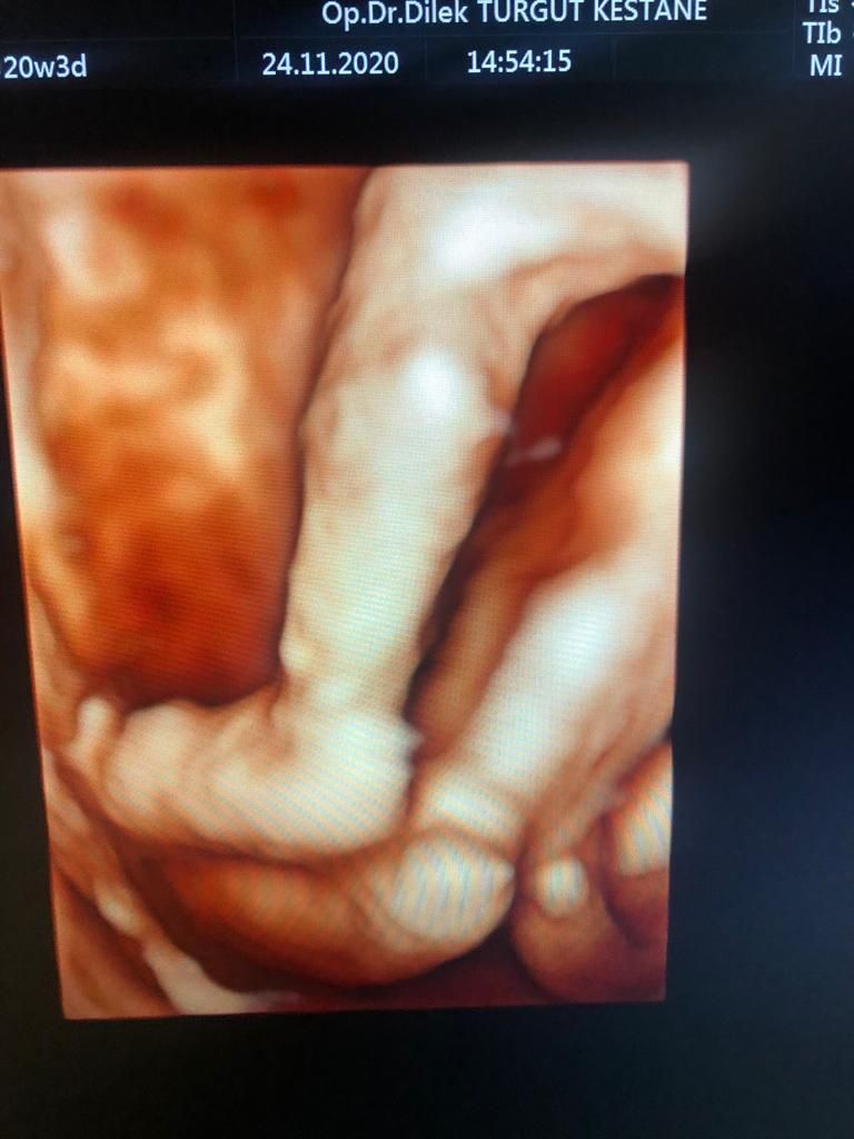 Dilek Turğut Kestane-2