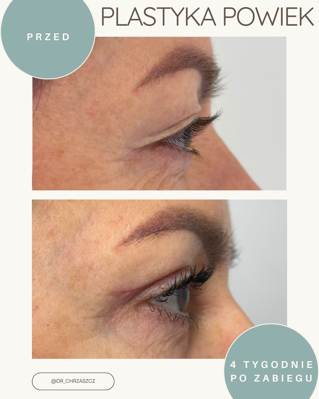 Michał Chrząszcz-6