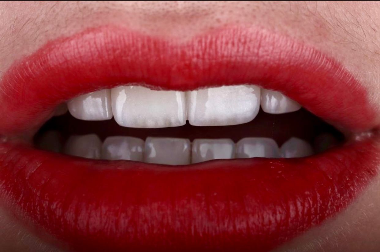 Antonio Del Salvatore-2