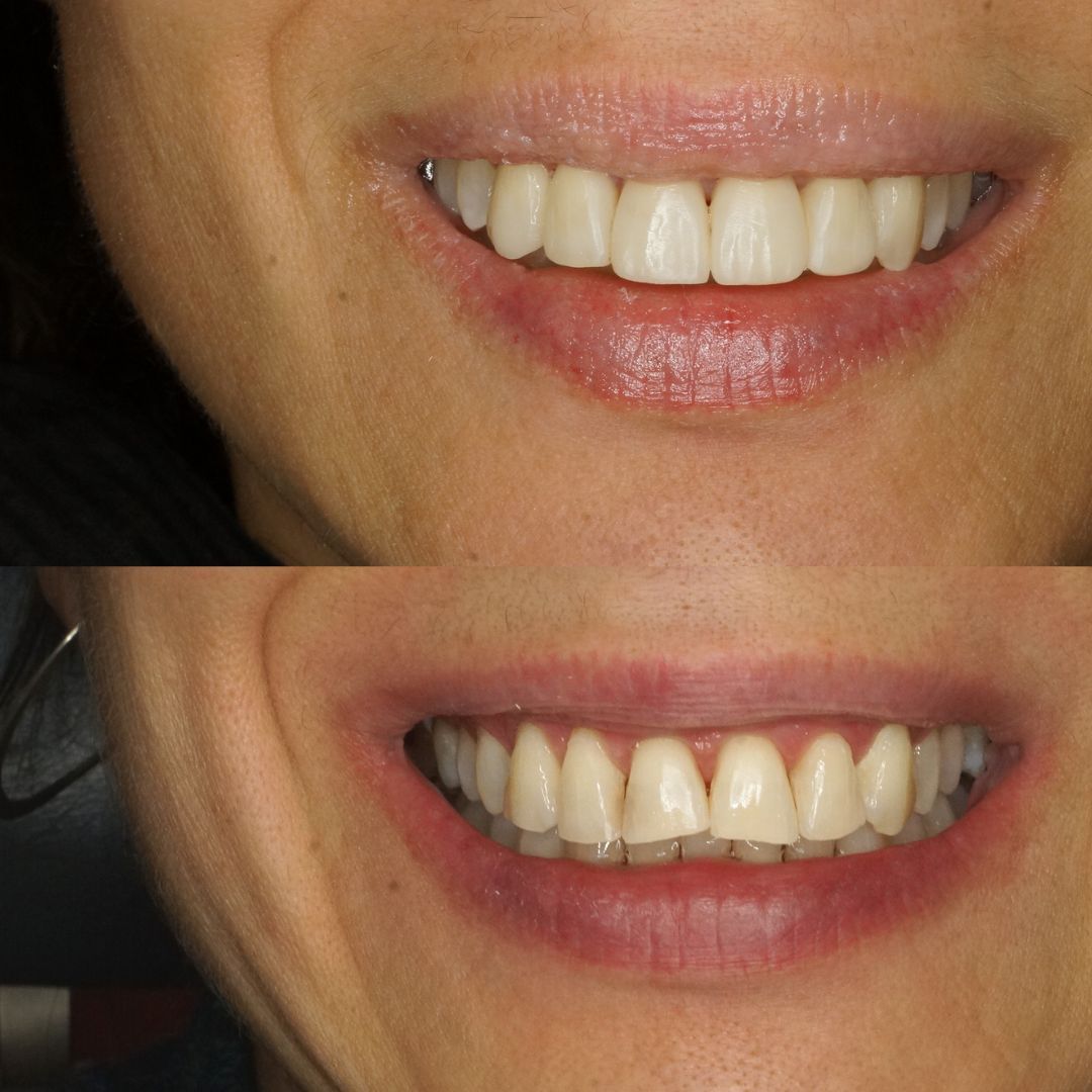 Raimonda Bogdanoviciute-26