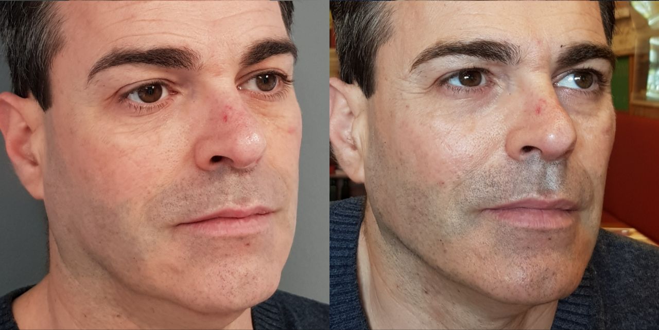 Rosalba Herrero Zerpa-155