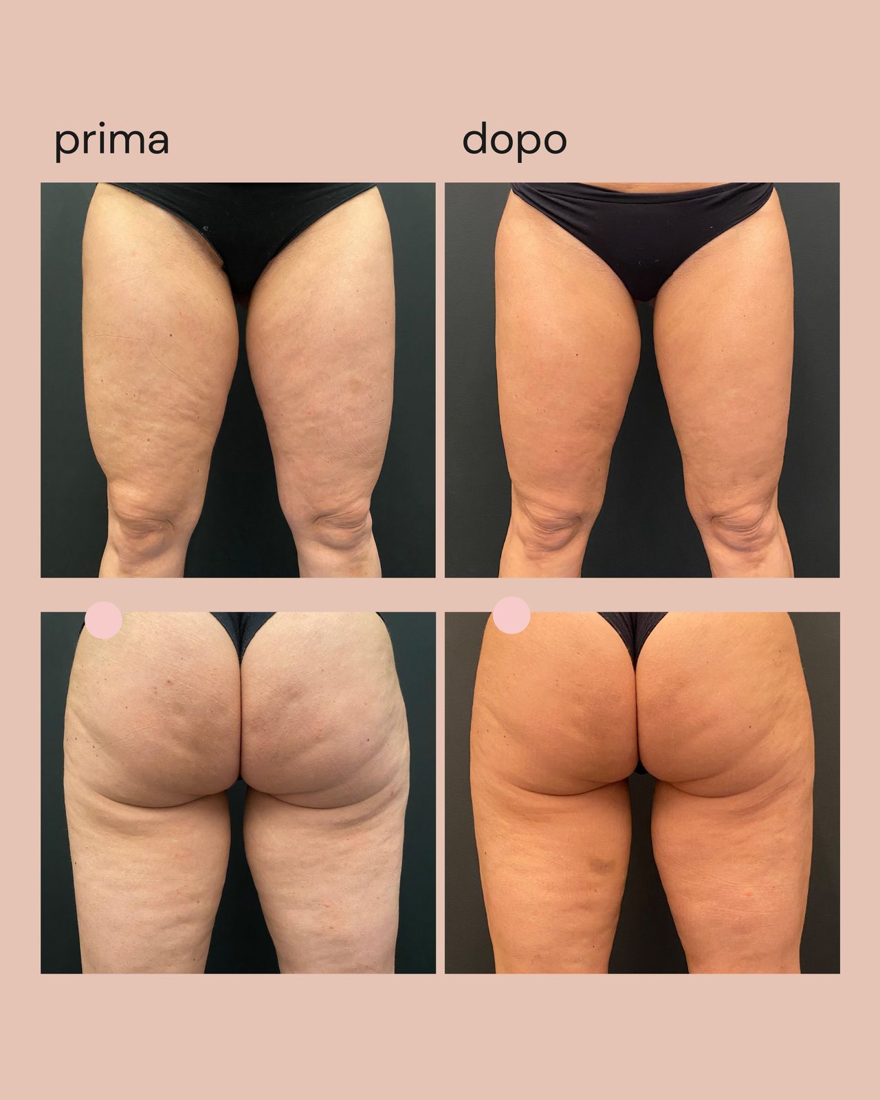 Liliana Turatello-1