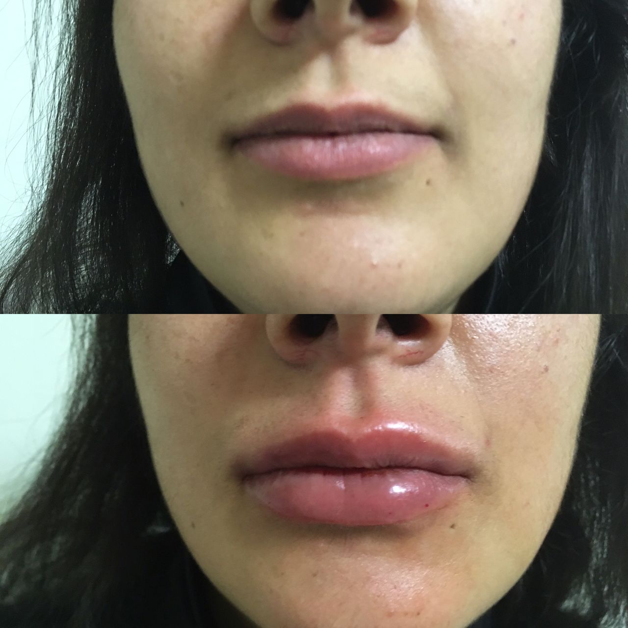 Virginia Cristina Rapisarda-86