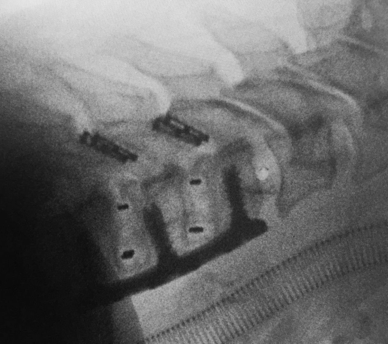 Juan Camilo Hernandez Acevedo-29