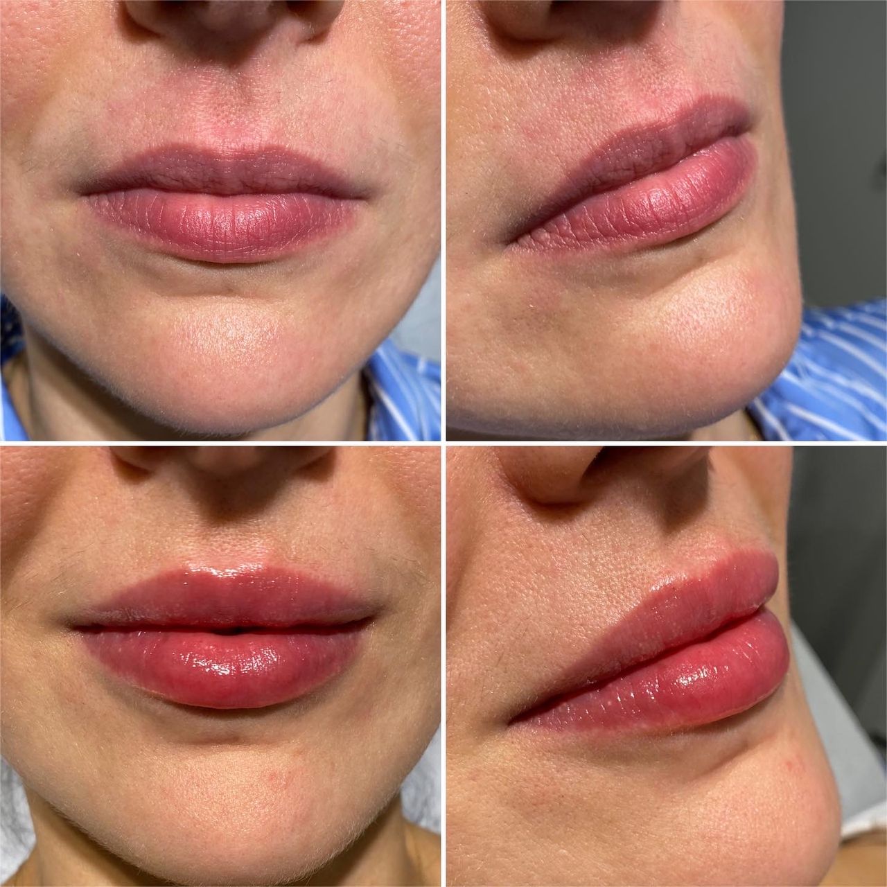 Magdalena Tworek (Słomka)-0