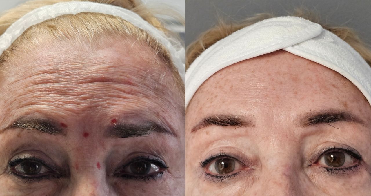 Rosalba Herrero Zerpa-460