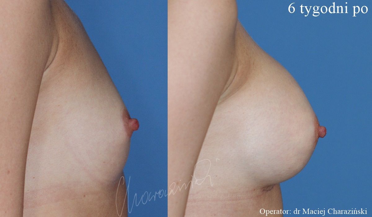 Maciej Charaziński-92